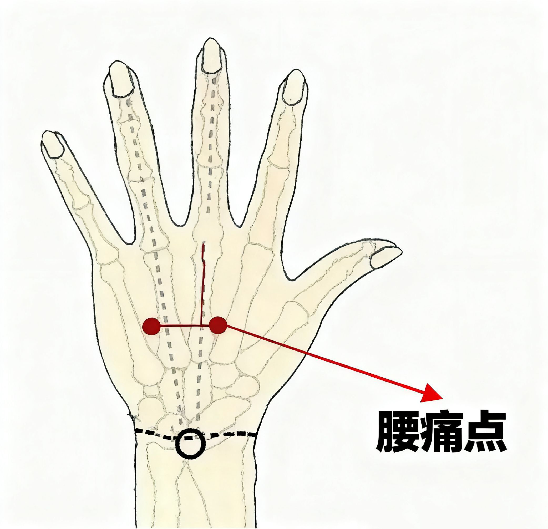 【每日一穴】手背上的腰痛急救穴