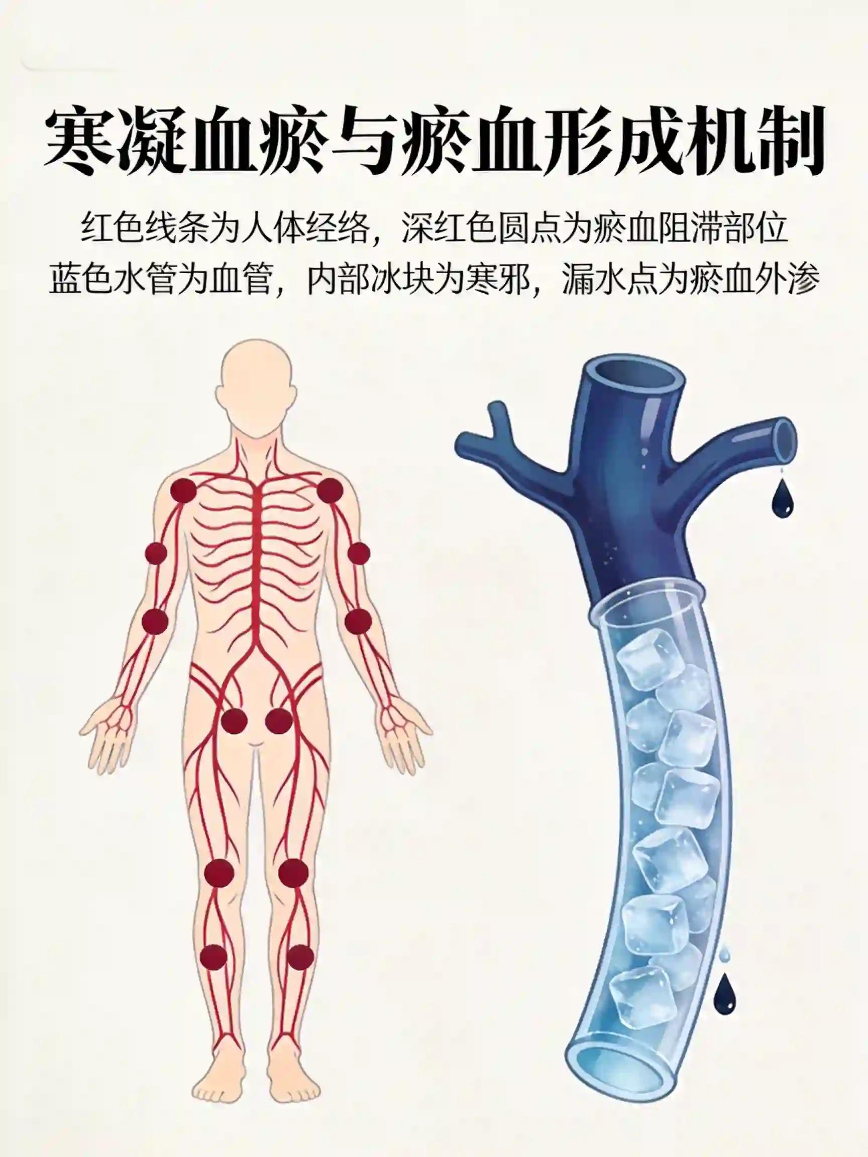 血瘀质详解:中医 视角下的“长斑派”体质