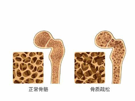 缺钙有什么表现和症状呢