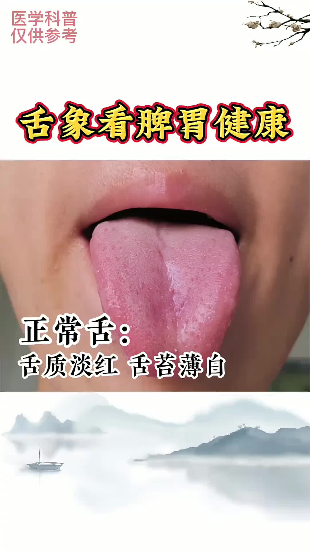 00004 通过舌象 看脾胃的健康。