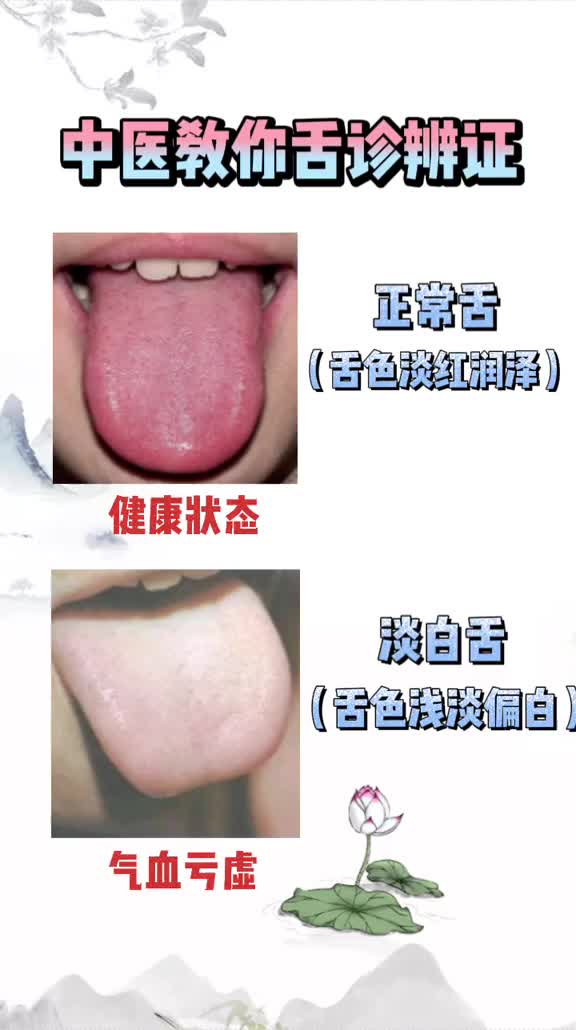 00018 中医教你舌诊辨证