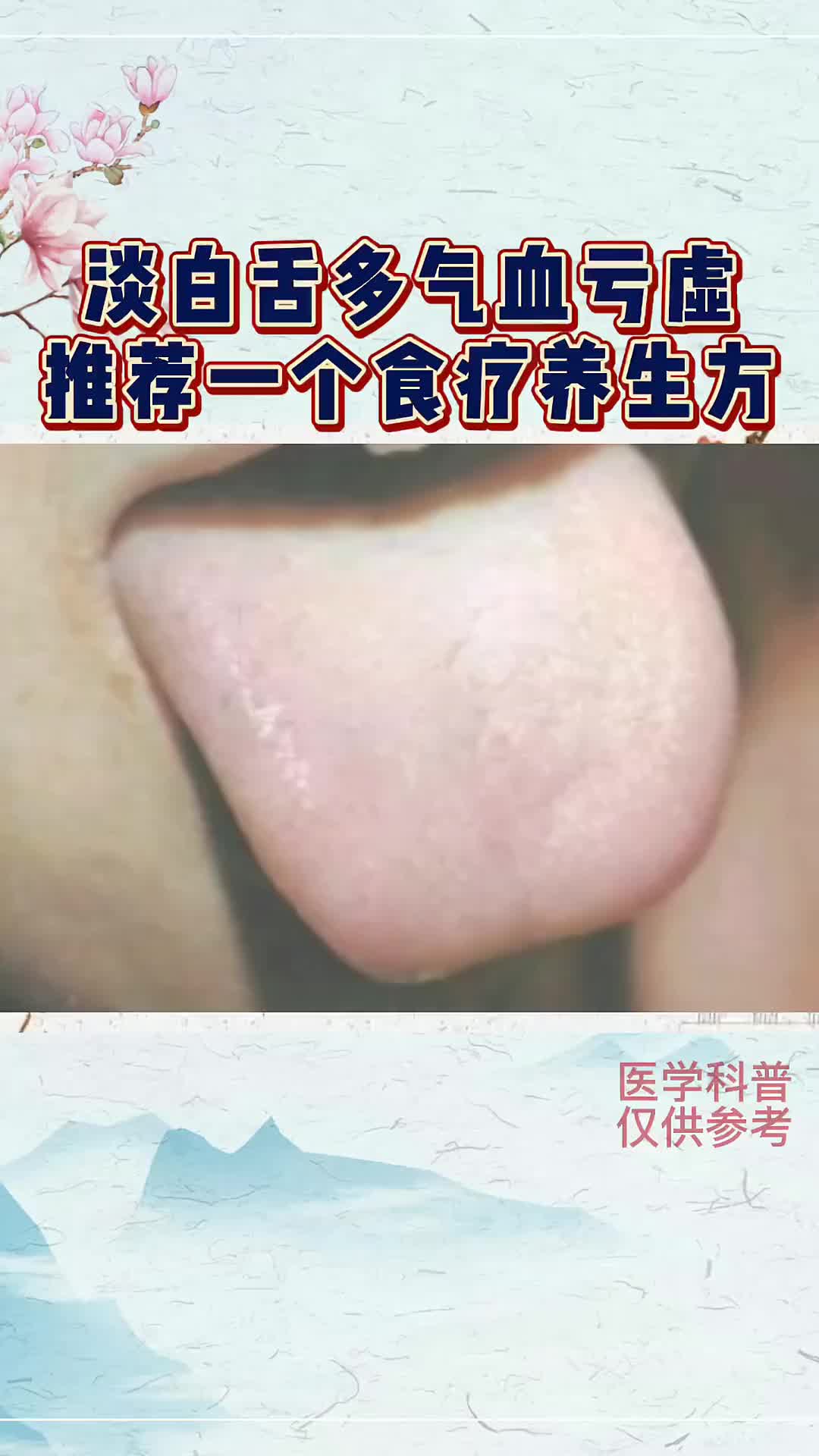 淡白舌治疗方子