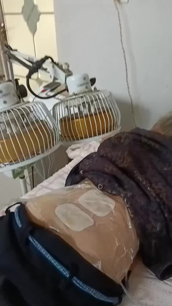 腰脊劳损治疗一次，劲元堂阿是穴位加药黄金搭档