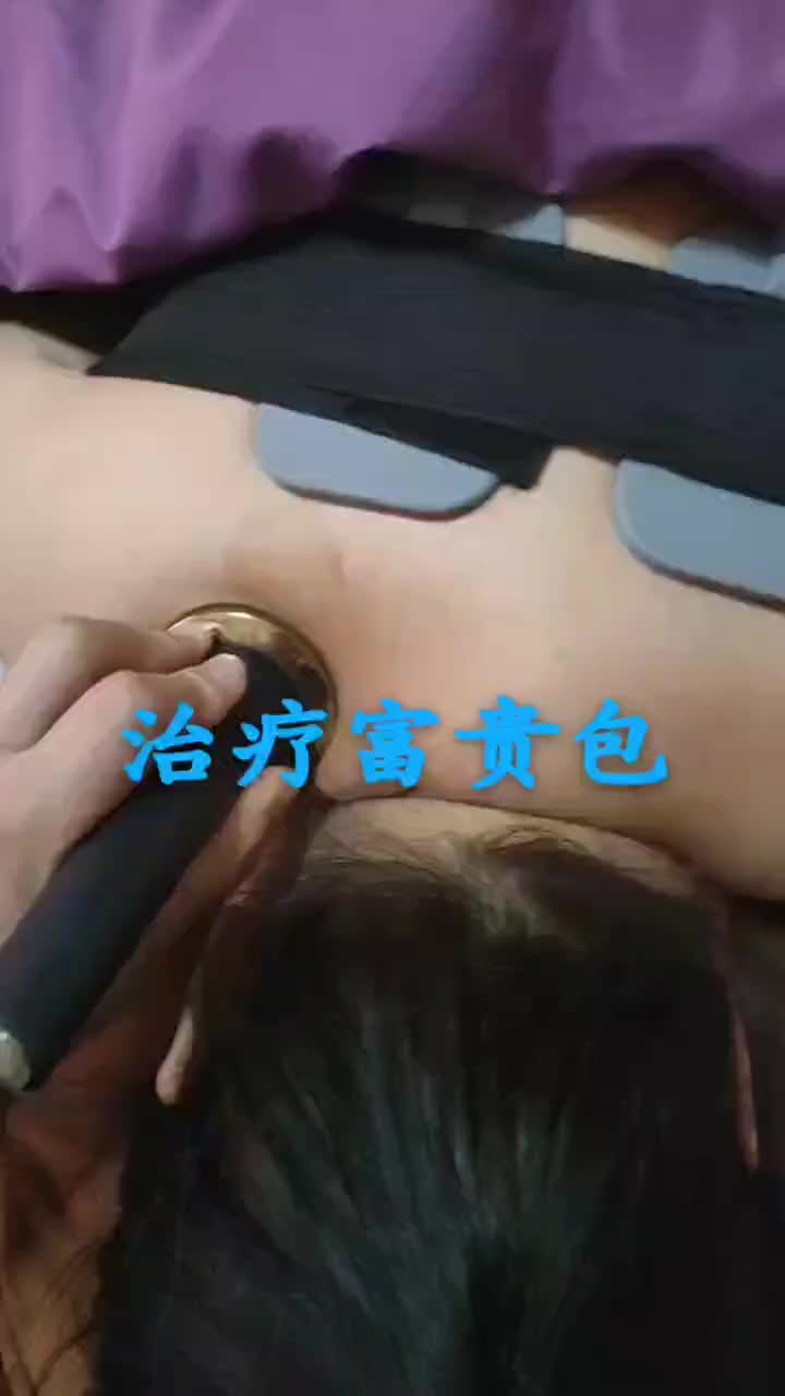 富贵包效果很好，患者体验感好