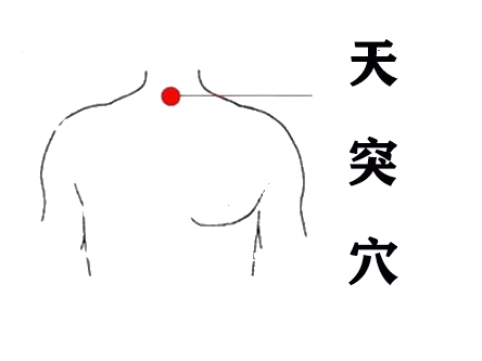 咳咳咳……止不住的咳嗽，中医外治巧治咳（二）