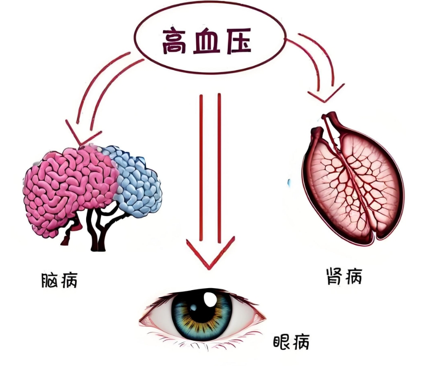 高血压对人体的危害?