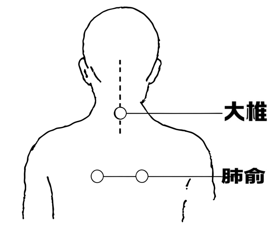 中医特色疗法——穴位贴敷