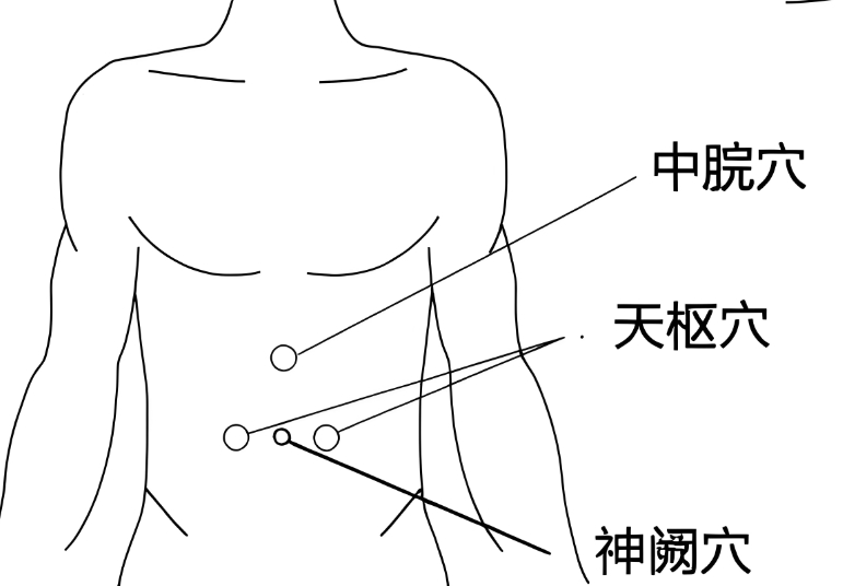 中医特色疗法——穴位贴敷