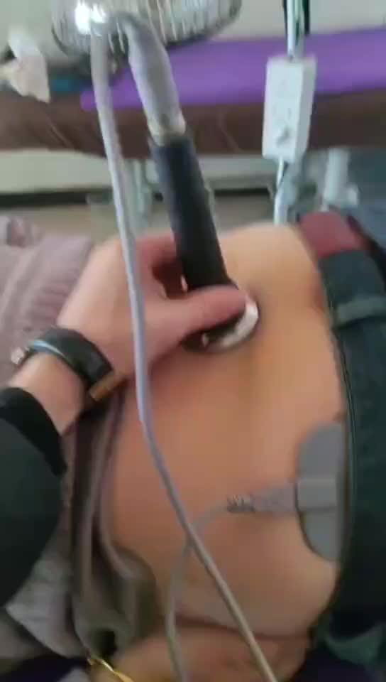 腰间盘突出