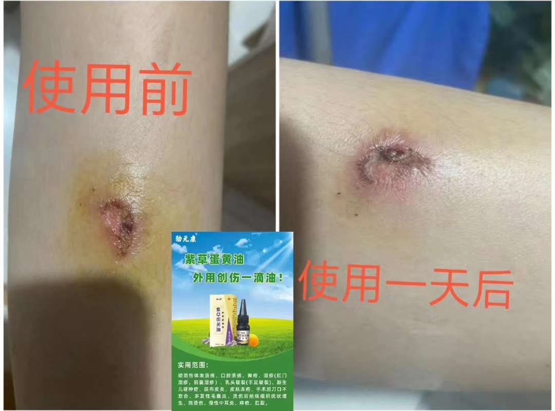 蛋黄油使用效果