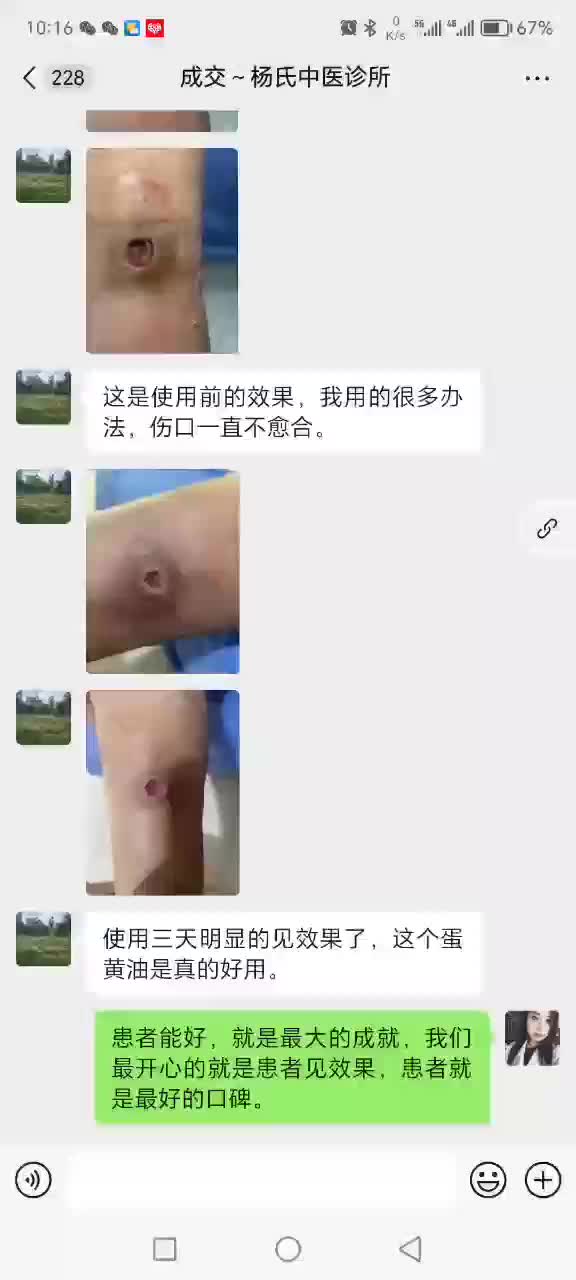 针对伤口不愈合有奇效