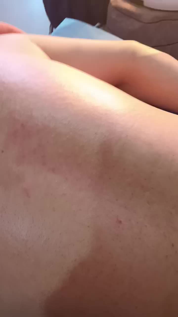 股骨头疼痛