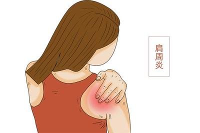 肩周炎与颈椎病如何区别？别再傻傻分不清！