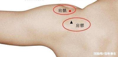 肩周炎拔罐拔什么部位？