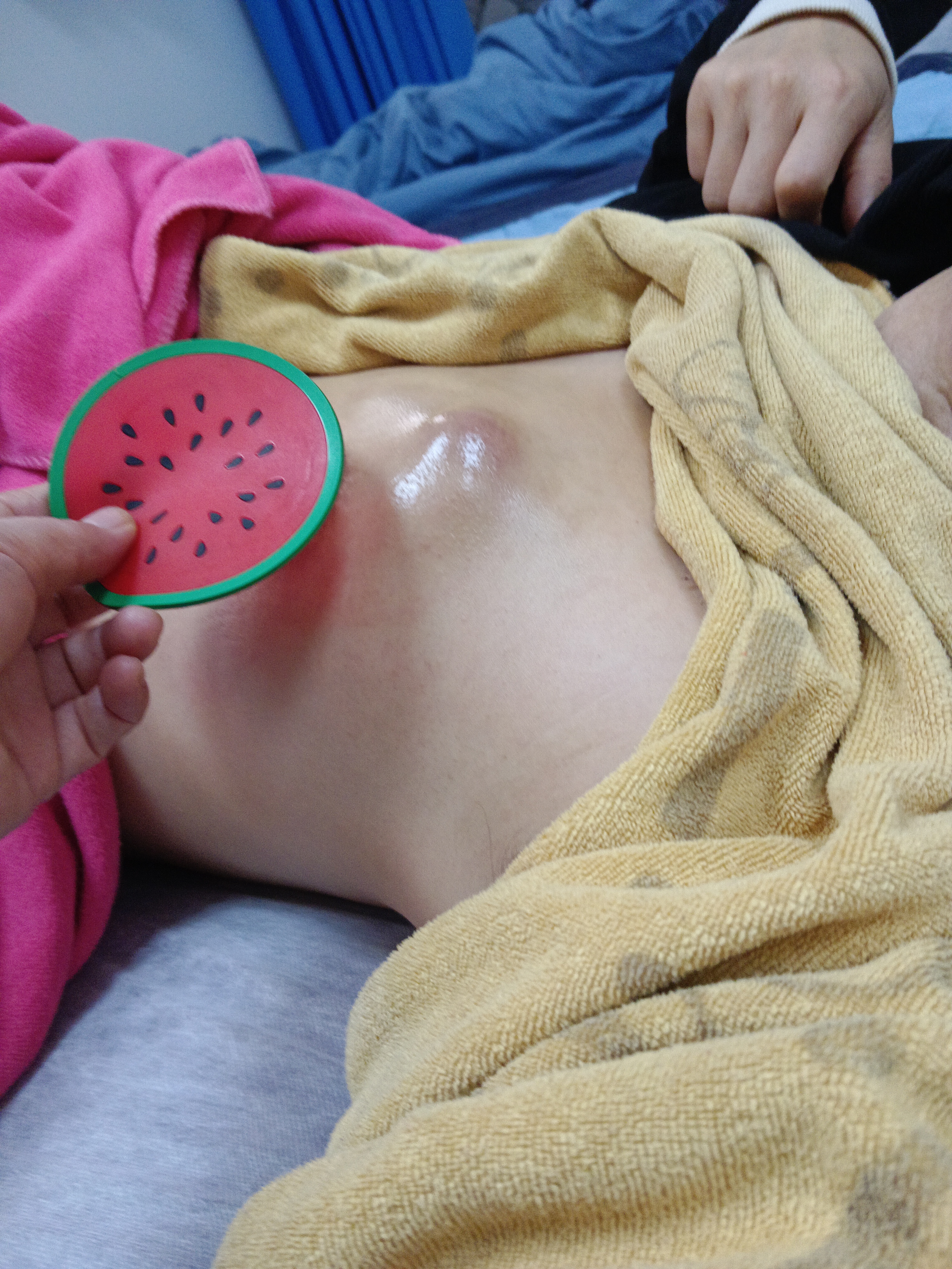 乳腺结节调理中